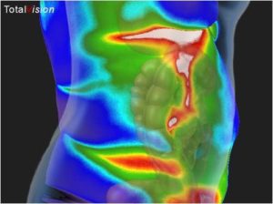 liver therm pic