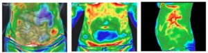 stress-levels-thermography