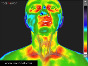 Neck | Lisa Mack Thermography | Health