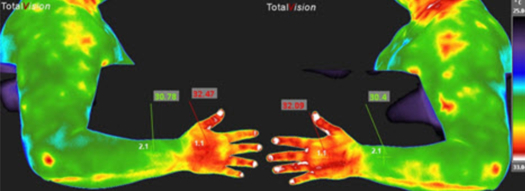 Hands and fingertips | Lisa Mack Thermology | Health | Lakeland Florida