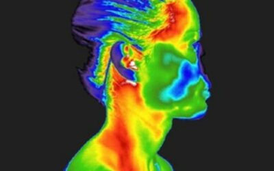 Stress Levels and Thermography
