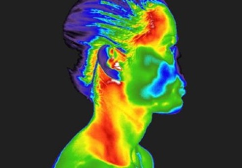 Stress Levels and Thermography