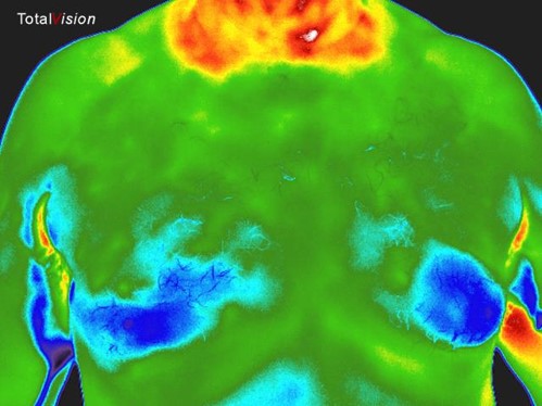 Visualize Men and Women’s Breast Health Differently Through Thermography