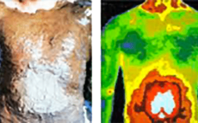 The History of Thermography